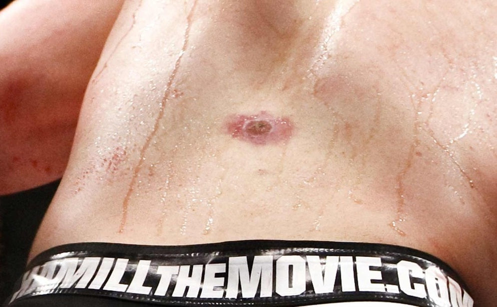 Why UFC Fighters Need L-Glutamine and Agave Inulin: The Gut Health Edge You're Ignoring
